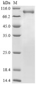 SDS-PAGE (PREP-542H).jpg